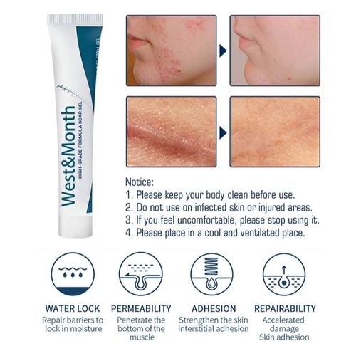 Gel de silicone de haute qualité pour l'élimination de toutes les cicatrices 20 g